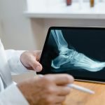 Ortho Acronyms